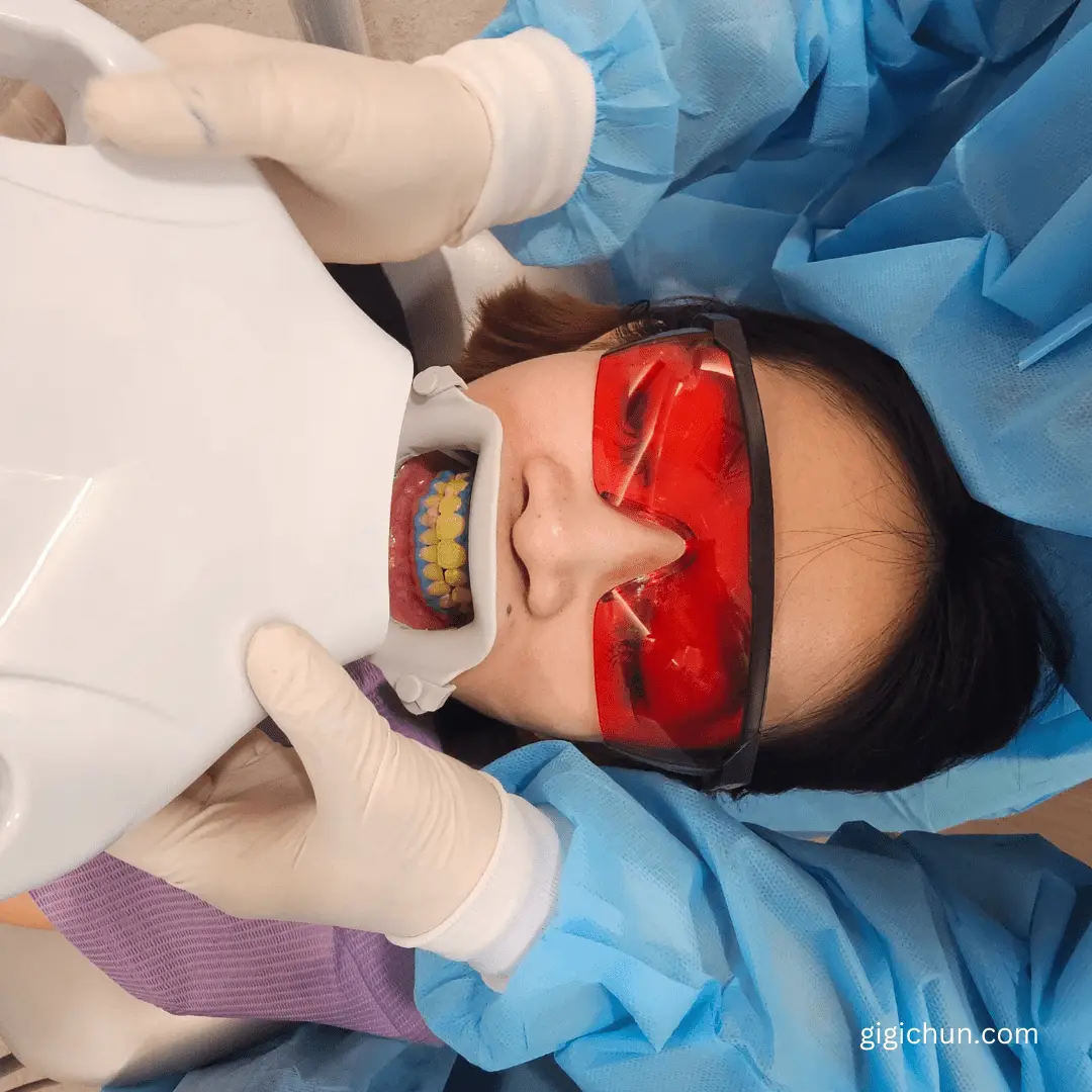 in office teeth whitening kl