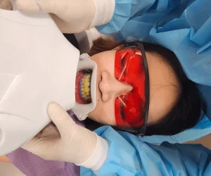 in office teeth whitening kl